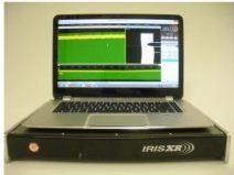 IRISXR 内置式旋转超声检测系统